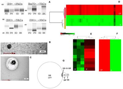 Plasma- and Saliva Exosome Profile Reveals a Distinct MicroRNA Signature in Chronic Periodontitis